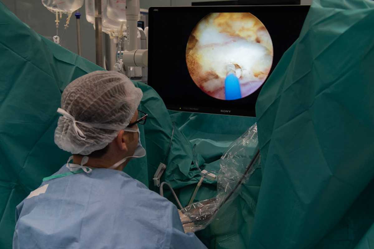 Nueva técnica láser en cirugías de próstata.